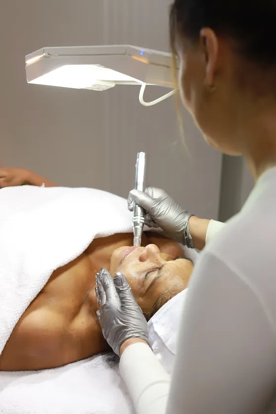 De microneedlingpen op het voorhoofd, onder de lamp